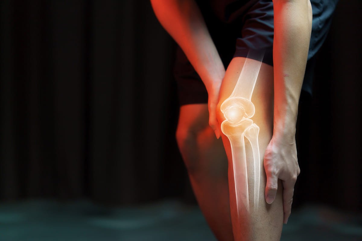 Knee Arthritis